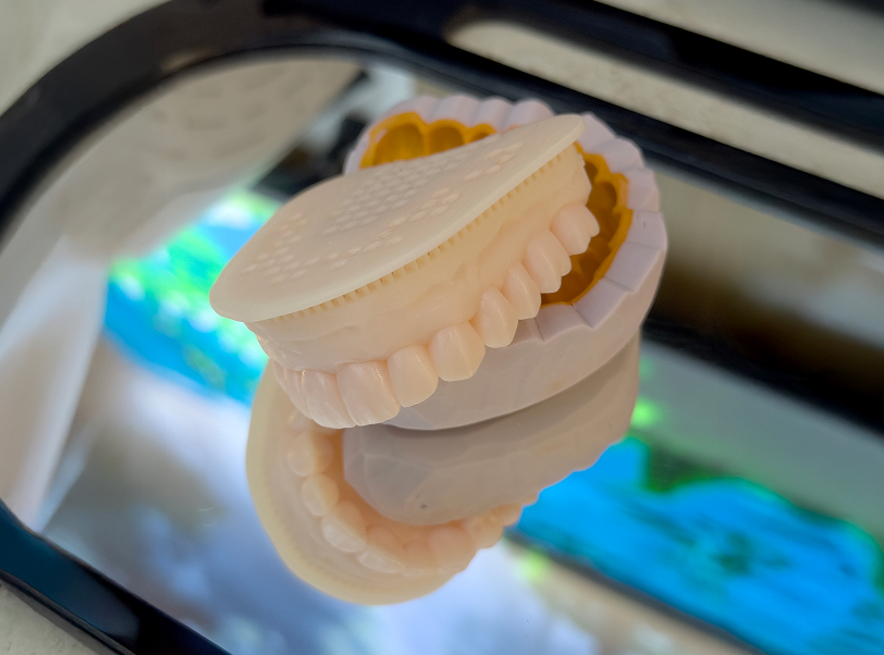 Facetas e lentes de contato - 7