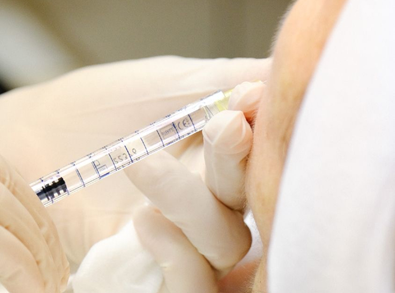 Harmonização Orofacial - 4