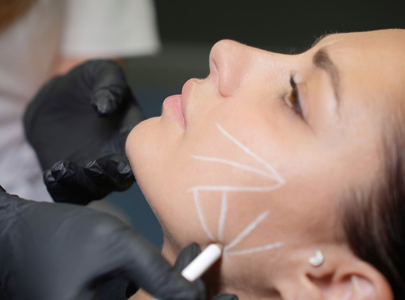 Harmonização Orofacial - 5