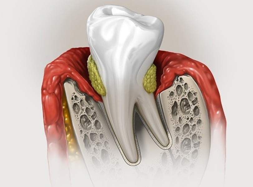 Periodontia - 2